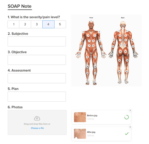 An image of SOAP notes forms within Vagaro's customer tracking software.